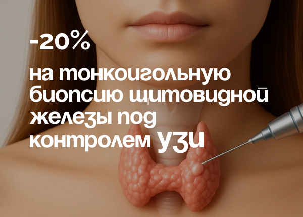 АКЦИЯ «БИОПСИЯ ЩИТОВИДНОЙ ЖЕЛЕЗЫ СО СКИДКОЙ 20%» 